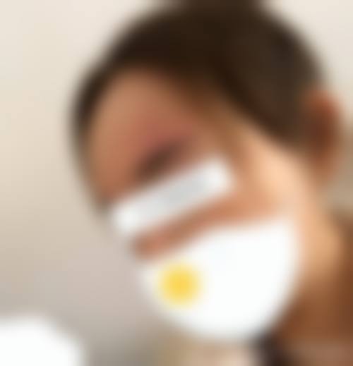 六、曼谷La Grace医疗美容诊所价格表:(仅供参考)
