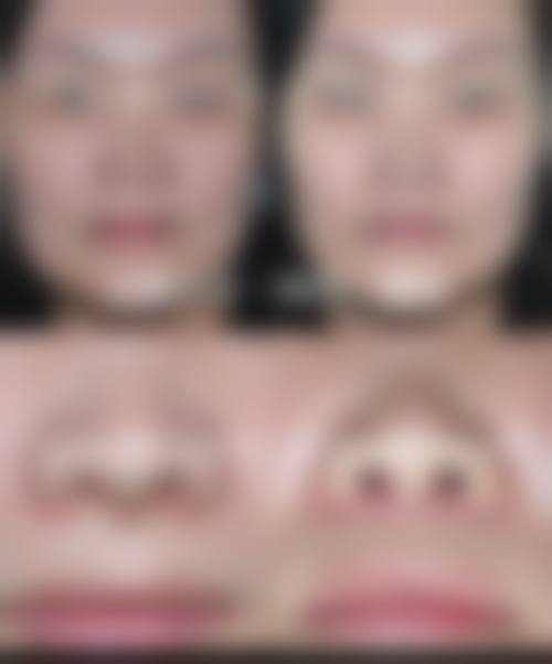 五、西安觅龄整形医院怎么预约：