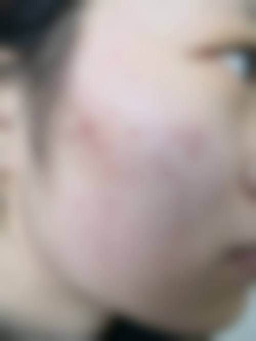 二、博多痤疮诊所正规吗？来看看医院资质：