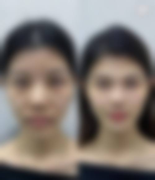 六、湖南益阳格莱美医疗美容医院怎么预约: