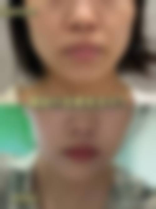 七、大连泊蔓医疗美容诊所真实的顾客评价如下: