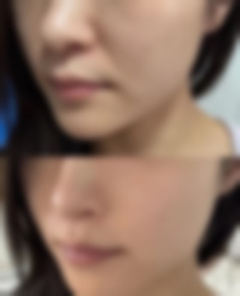 消除熬夜眼袋,日常注意事项不能忘