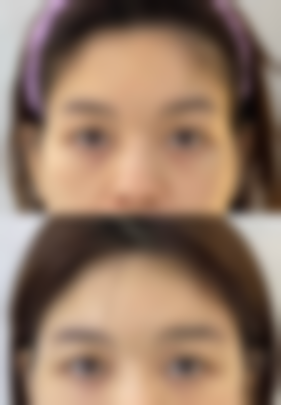 八、湖南益阳格莱美医疗美容医院真实的顾客评价如下:
