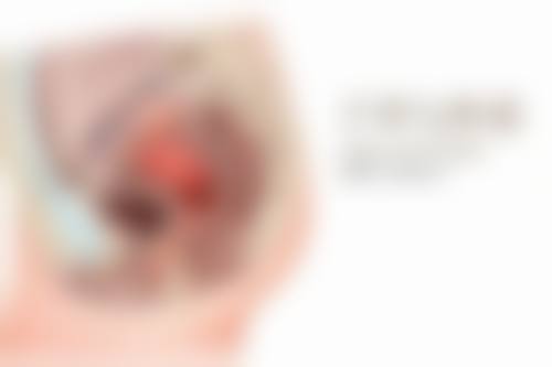 手术增生的疤痕去除之综合治疗方案