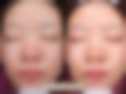 五、青海西宁绣妤医疗整形美容实例