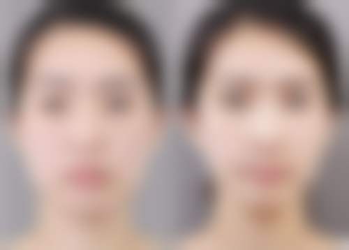 八、上海丽人整形美容医院真实的顾客评价如下：