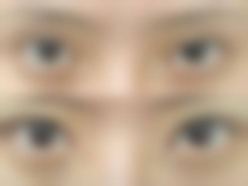 七、沈阳市艾咪整形外科机构价格表:(仅供参考)