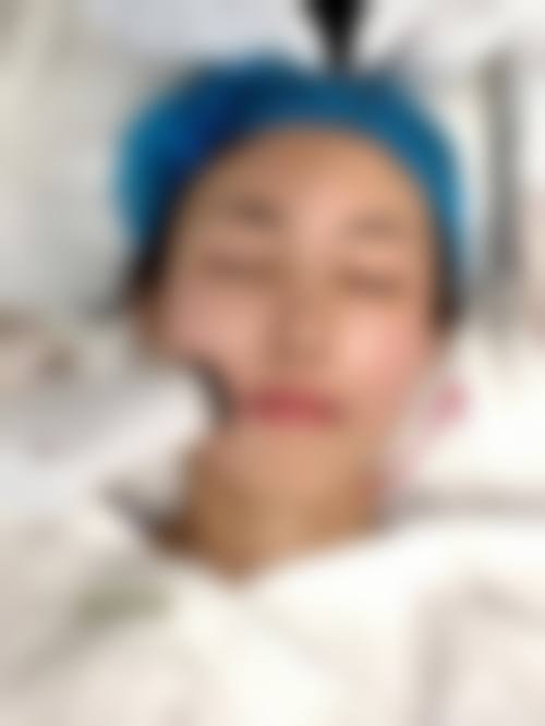 四、承德铧中整形医院实例