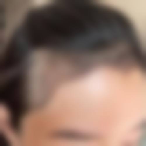 四、大庆亿美整形医院开展的主要项目和特色项目:
