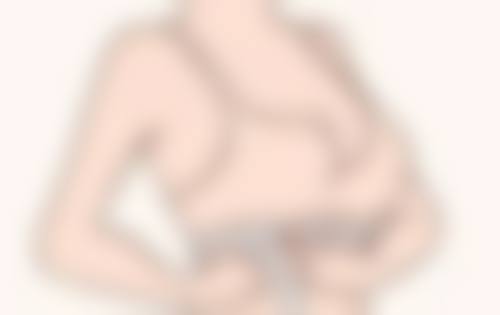揭秘合资隆胸假体:非独立品牌系列优势