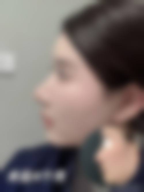八、南京乐颜美赋整形医院真实的顾客评价如下: