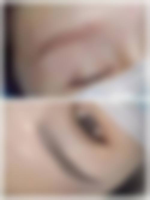七、清远雍禾植发医院价格表:(仅供参考)