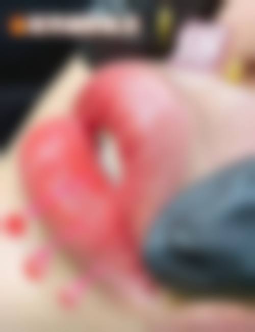 六、南京恒丽整形医院怎么预约：