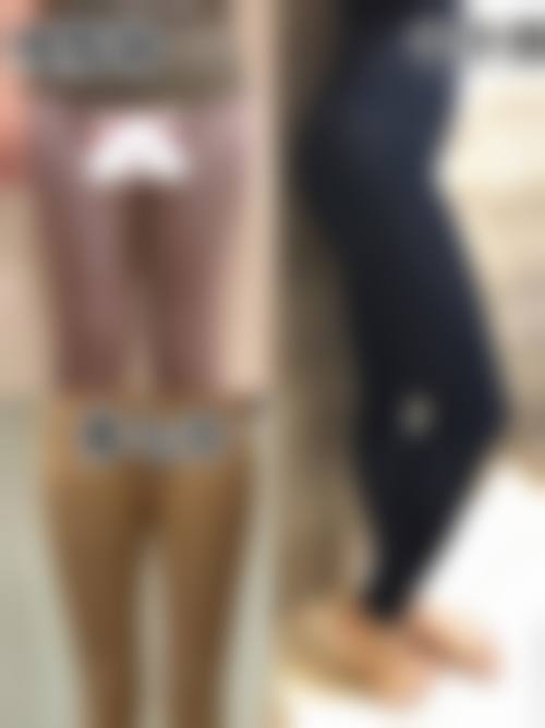 七、杭州俏佳人绽美整形医院价格表:(仅供参考)