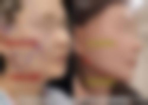 五、南京容爱整形医疗美容医院实例
