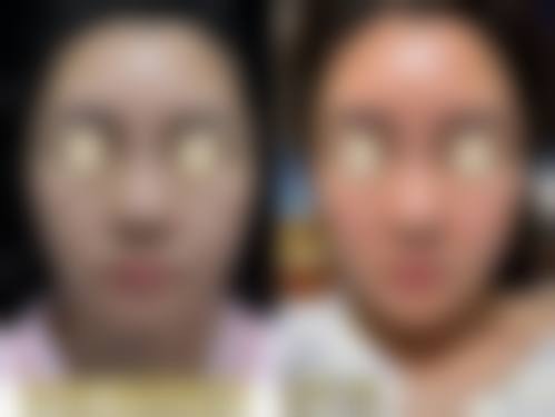 七、南京容爱整形医疗美容医院价格表:(仅供参考)