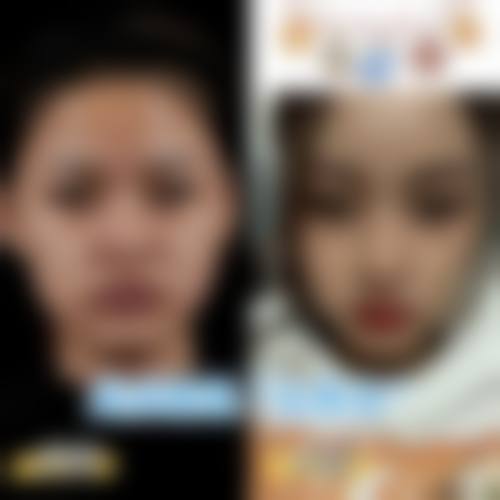 八、杭州优医联合医疗美容诊所真实的顾客评价如下: