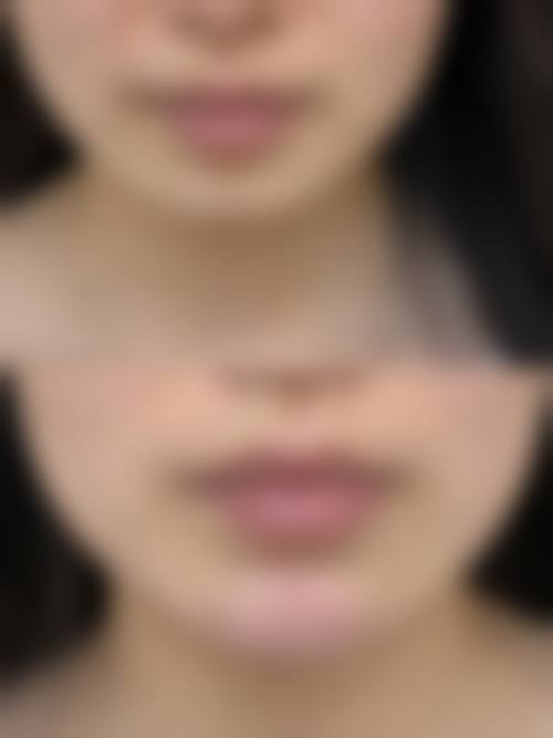 五、杭州优医联合医疗美容诊所实例