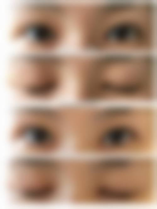 五、浙江大学医学校附属第二医院(整形科)实例