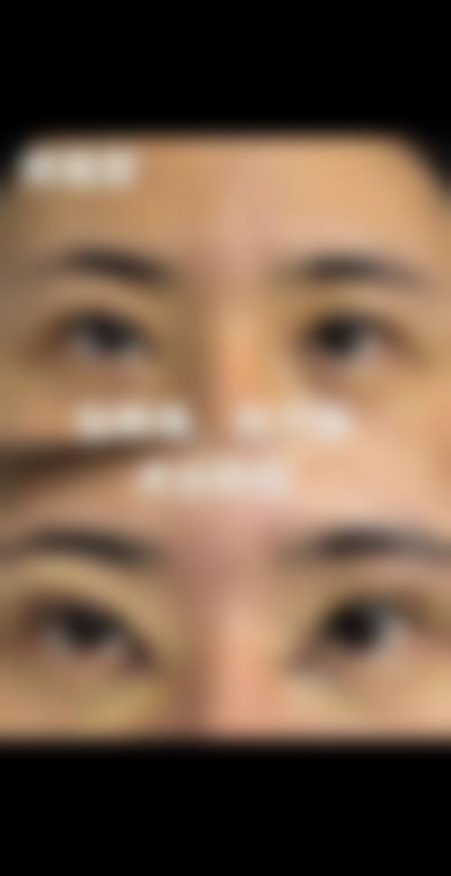 七、银川奥蕊斯医疗美容价格表：（仅供参考）