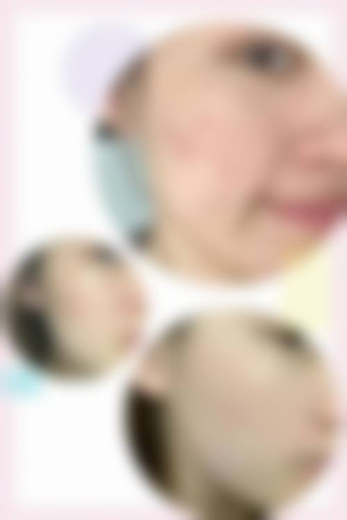 八、长春润堂林氏皮肤门诊部真实的顾客评价如下: