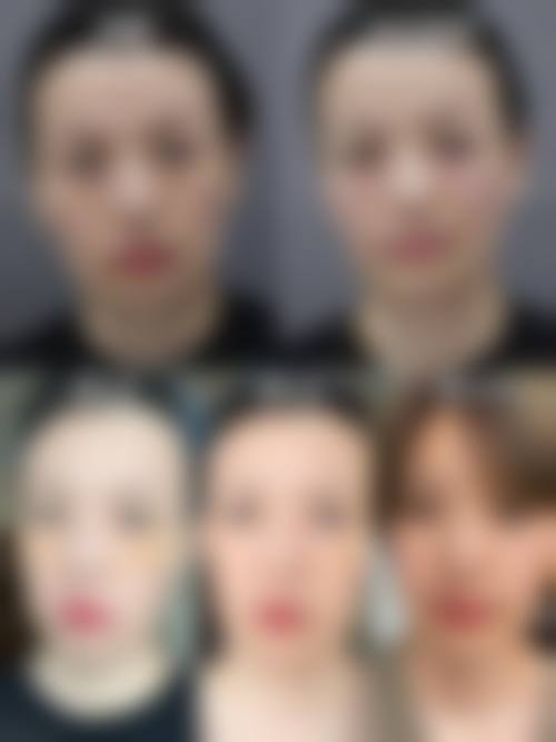 八、广州天博医疗医疗美容门诊部真实的顾客评价如下: