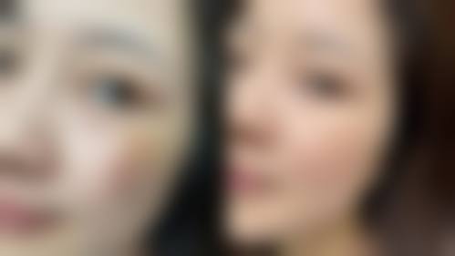五、玉溪蕾特恩专精祛痘连锁怎么预约：