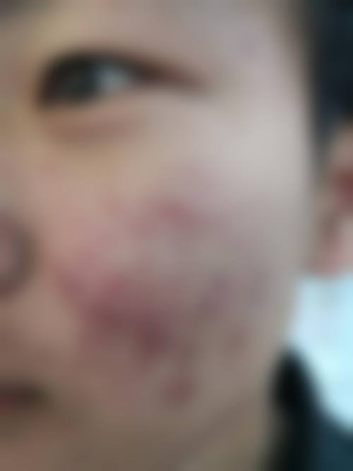 二、玉溪蕾特恩专精祛痘连锁正规吗？来看看医院资质：