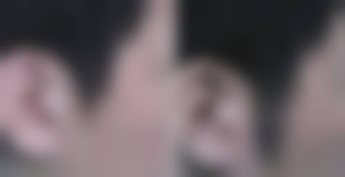 五、杭州碧莲盛植发实例