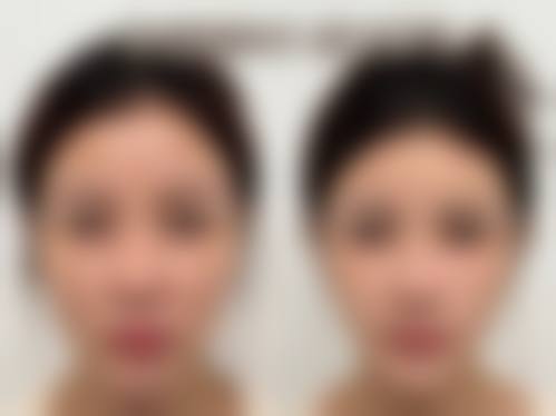 七、太原黛圣医疗美容诊所真实的顾客评价如下: