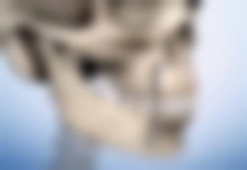 双眼皮术后出血莫急!关注出血状态辨情况