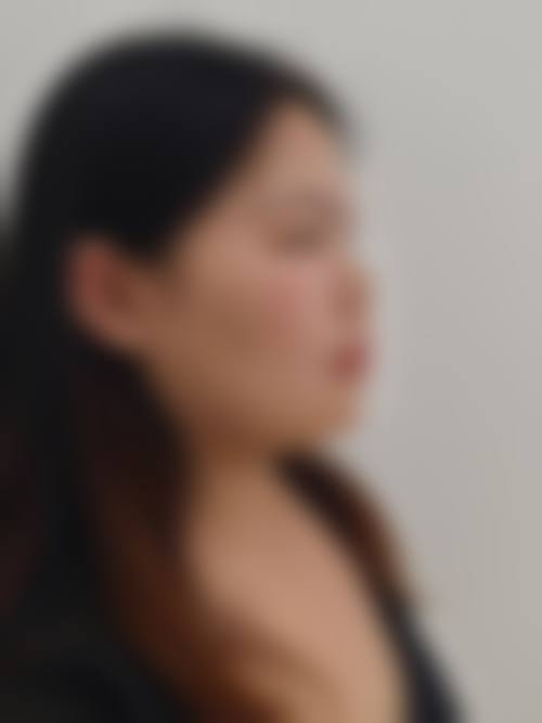 六、福州莎菲琳(弘宇)整形美容医院怎么预约:
