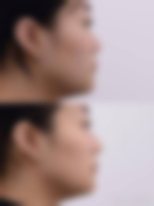 七、西安西美西 京整形医院价格表:(仅供参考)