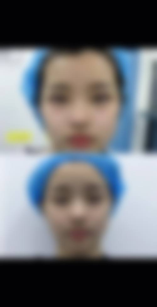 五、楚雄壹心医疗美容诊所怎么预约