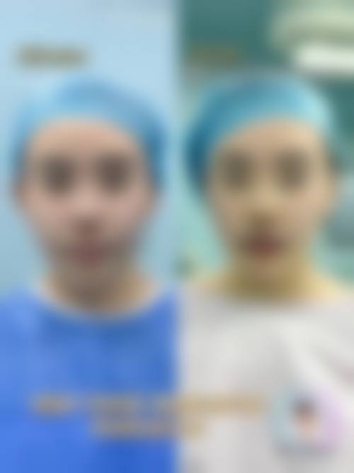 六、天津东方熙颜整形医院怎么预约: