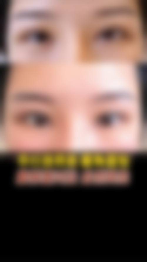 五、深圳市第二人民医院整形科实例