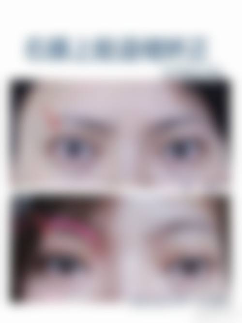八、深圳市第二人民医院整形科真实的顾客评价如下: