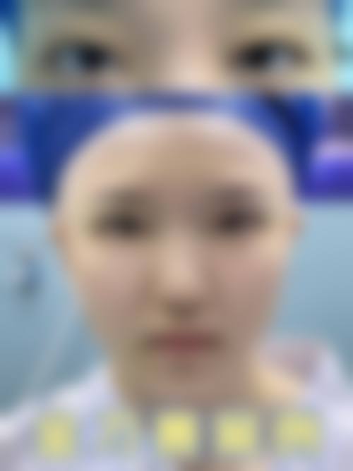 二、深圳市第二人民医院整形科正规吗?来看看医院资质:
