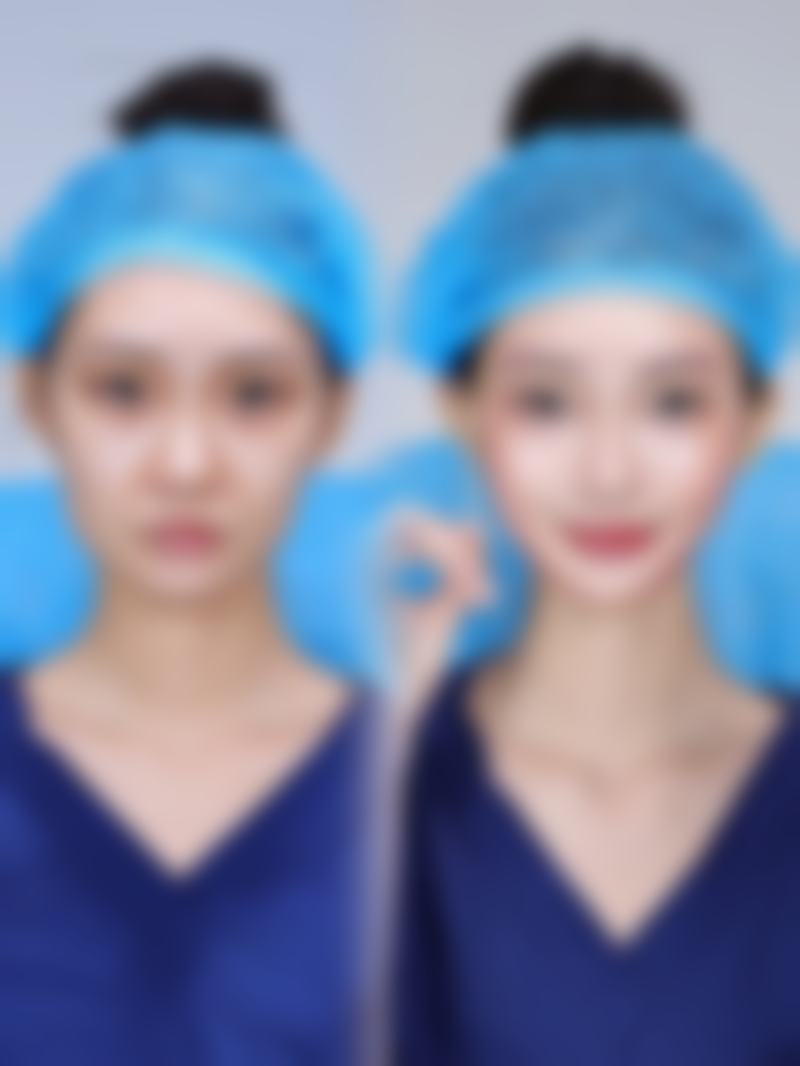 五、广州焕颜整形医院怎么预约：