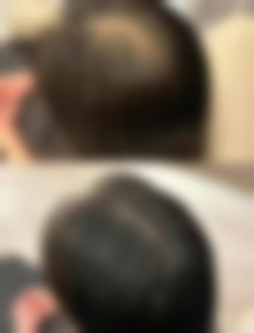 六、南通科禾植发医疗美容诊所怎么预约：