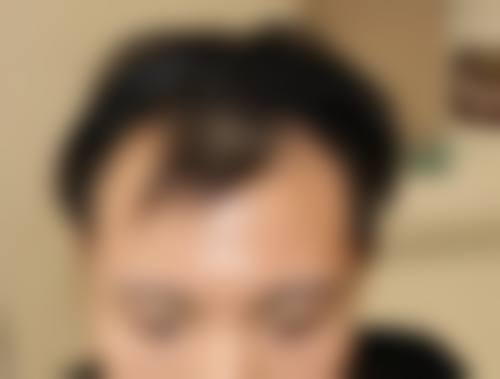 八、南通科禾植发医疗美容诊所真实的顾客评价如下：