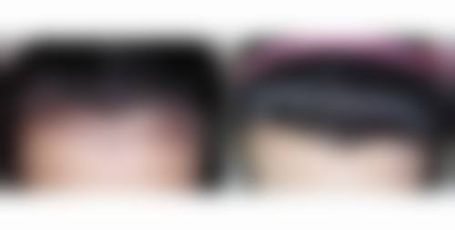 五、南通科禾植发医疗美容诊所实例