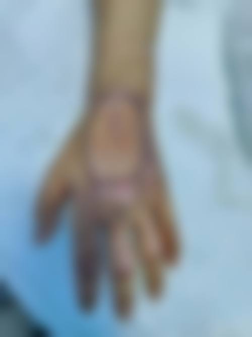 朱逸医生在哪家医院怎么预约？