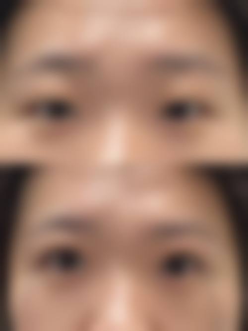 七、烟台华怡医学美容医院价格表：（仅供参考）