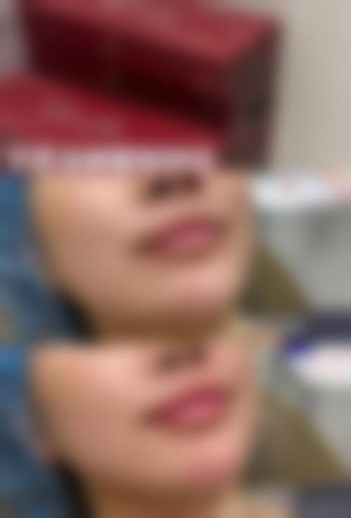 四、苏州壹秒医疗美容实例
