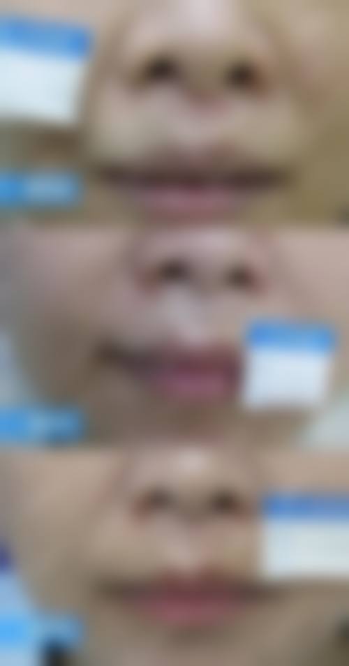 张路灯医生实例