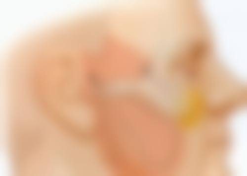 割双眼皮修复终极攻略:快速拥有自然无痕双眼皮