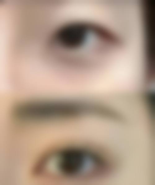 二、深圳悦美莉医疗美容门诊部正规吗?来看看医院资质: