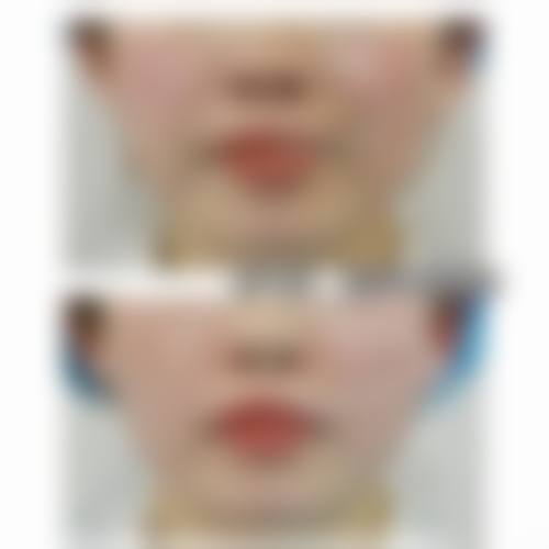七、景德镇伊莱美医疗美容诊所真实的顾客评价如下：