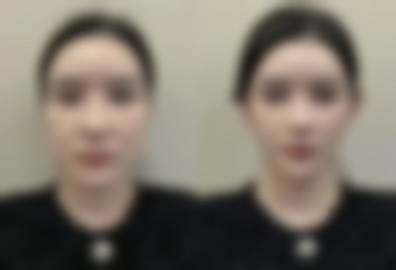 实用方法之涂抹药物消除缝针疤痕